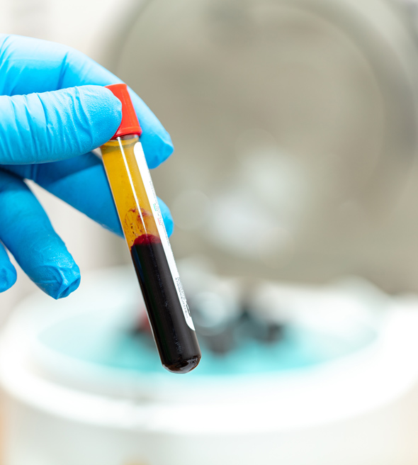 gloved hand holding a collection tube with layered blood samples indicating a medical procedure for testing three types of components