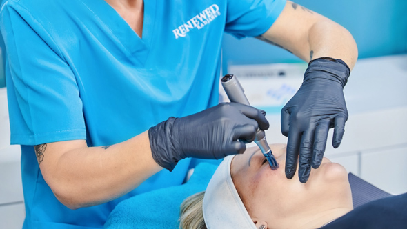 A medical professional in blue scrubs performs a skincare treatment using a microneedling device on a patient lying back with a headband on in a modern clinic setting 5 skincare tips for healthy skin